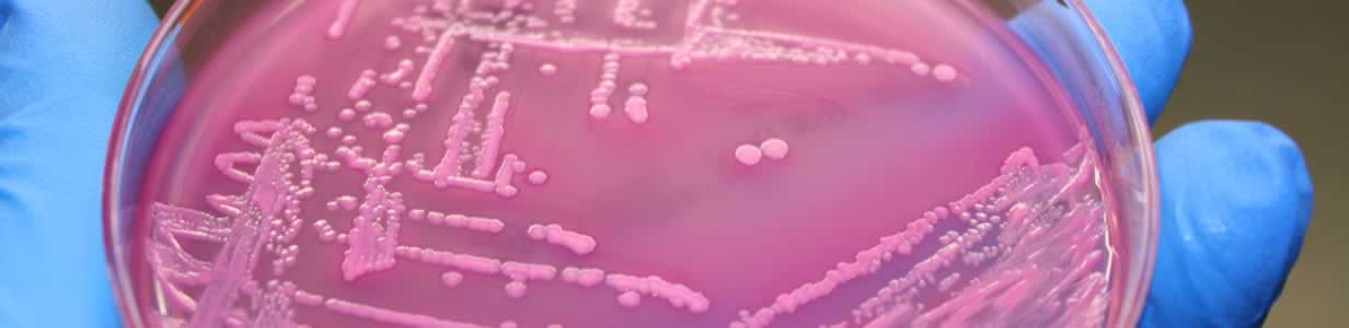 E.Coli Outbreaks - Preventable or Fact of Life?